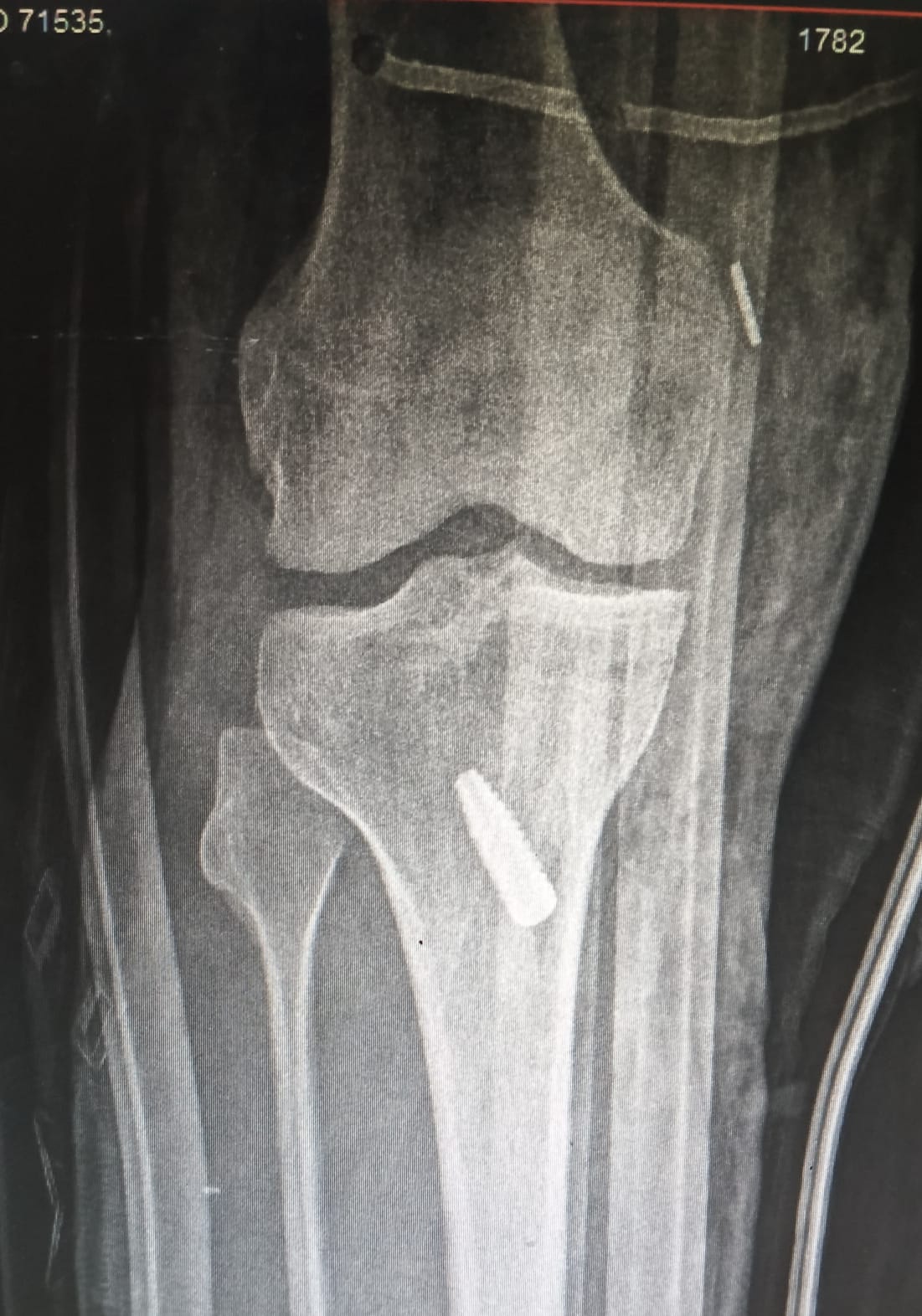 WhatsApp Image 2025-04-24 at 11.45.02 (1)