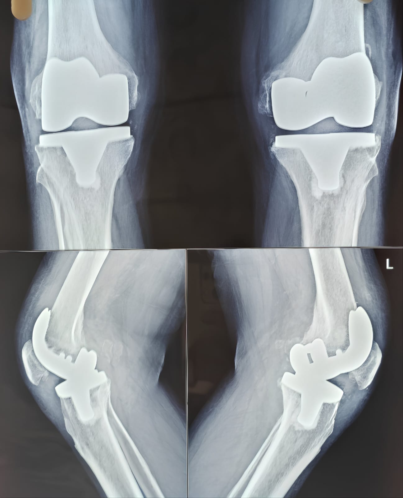 WhatsApp Image 2025-04-24 at 11.45.02