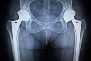 WhatsApp Image 2025-04-24 at 11.45.03 (1)