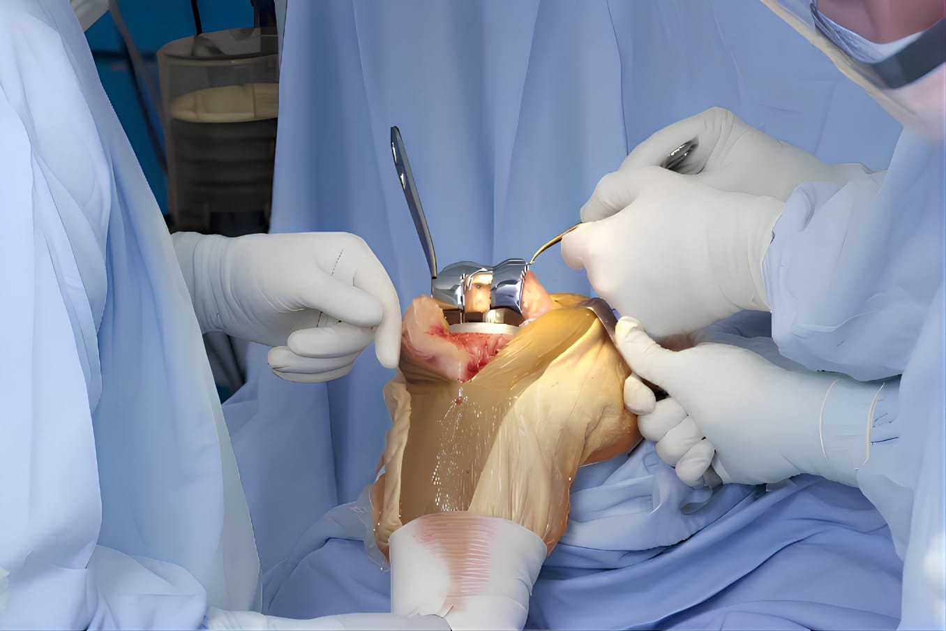 WhatsApp Image 2025-04-24 at 11.45.03 (2)