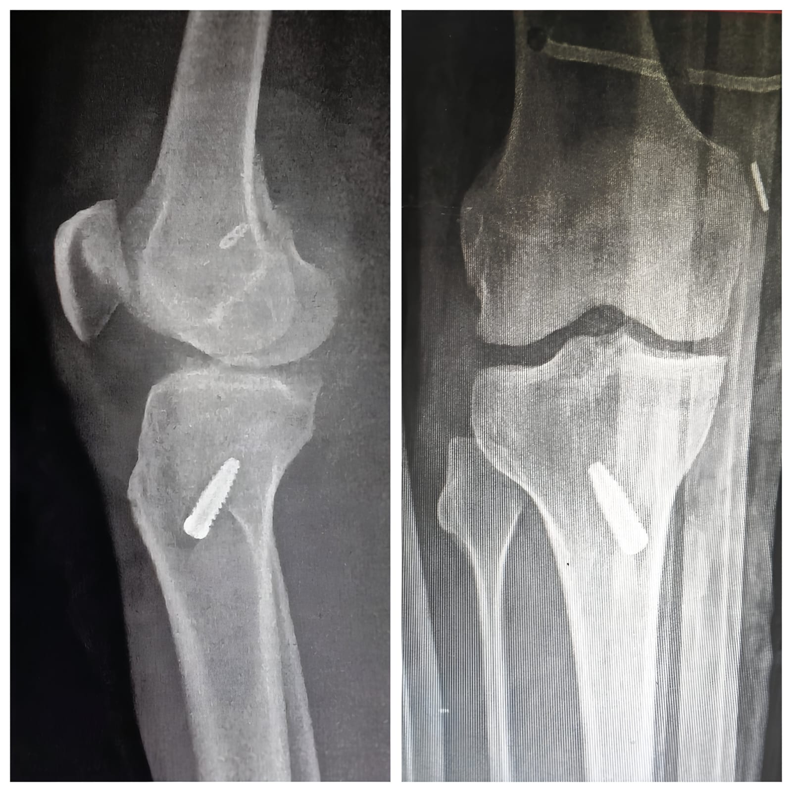 WhatsApp Image 2025-04-24 at 11.45.03