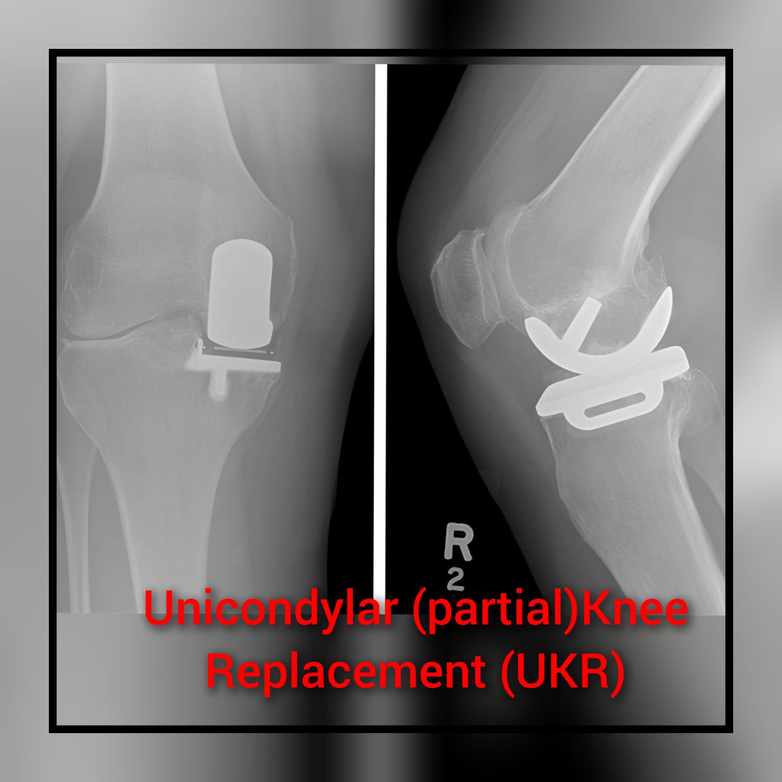 WhatsApp Image 2025-04-24 at 11.45.05 (1)