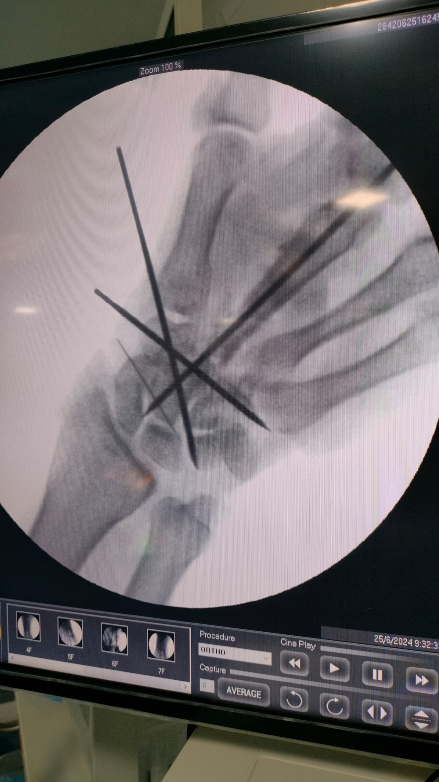 WhatsApp Image 2025-04-24 at 18.04.29