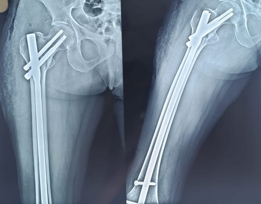 WhatsApp Image 2025-04-24 at 18.04.32